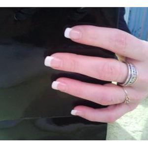 esthétique/prothésie ongulaire